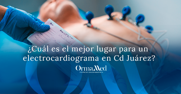 ¿Cuál es el mejor lugar para un electrocardiograma en Cd Juárez?