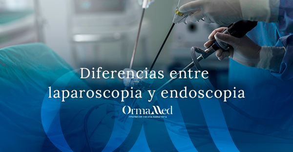 Diferencias entre laparoscopia y endoscopia