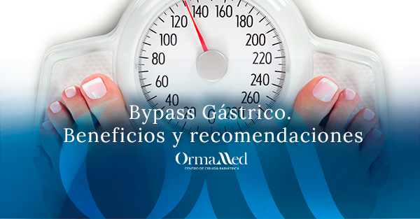Bypass Gástrico. Beneficios y recomendaciones