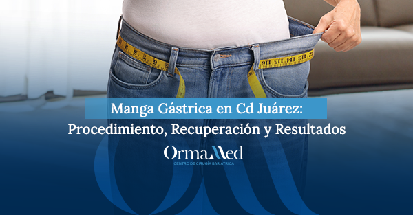 Manga Gástrica en Cd Juárez: Procedimiento, Recuperación y Resultados